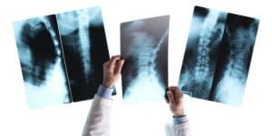 smaltimento lastre radiografiche